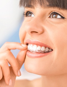 Woman using Invisalign clear aligner