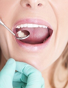 Dentist examining teeth