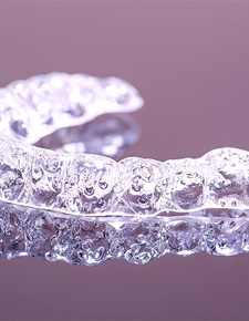 Invisalign alignment tray