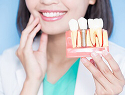 Friendswood dentist holding model of dental implants 