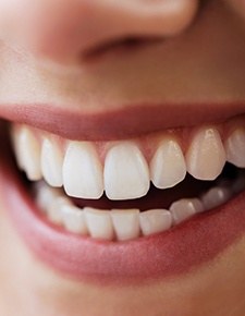 Closeup of smile with partial dentures