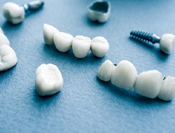 Different types of dental implants in Friendswood on blue background