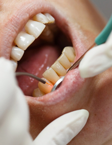 Closeup of man receiving Chao pinhole surgical technique treatment