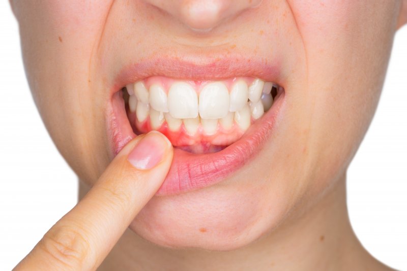 woman shows red spot on gums